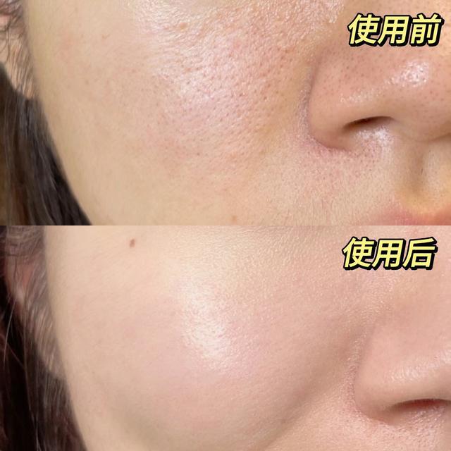 肤小吊瓶水光帮你告别无效补水OG真人平台秋冬季护肤攻略肌(图2)