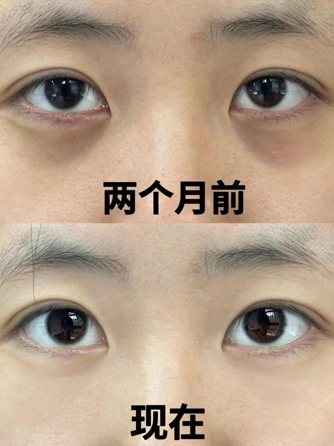 最好？别太会挑十款实力很强的眼霜OG网站眼霜哪个牌子抗皱去皱效果(图3)