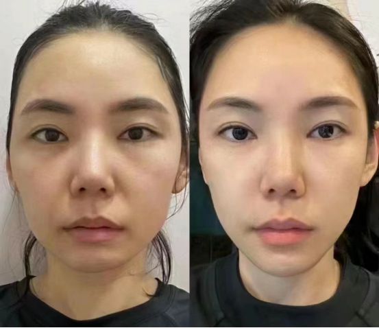 024最值得入手的抗皱国货分享OG真人抗老去皱纹护肤品推荐2(图5)
